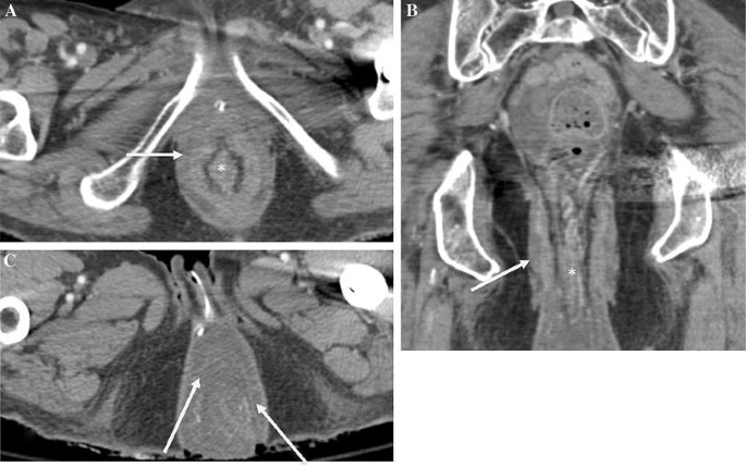 figure 19