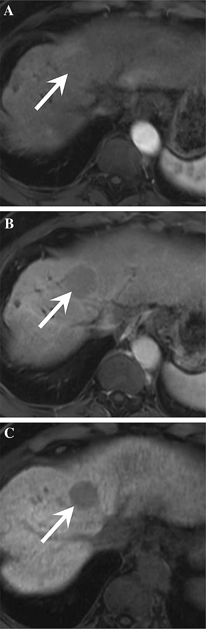 figure 18