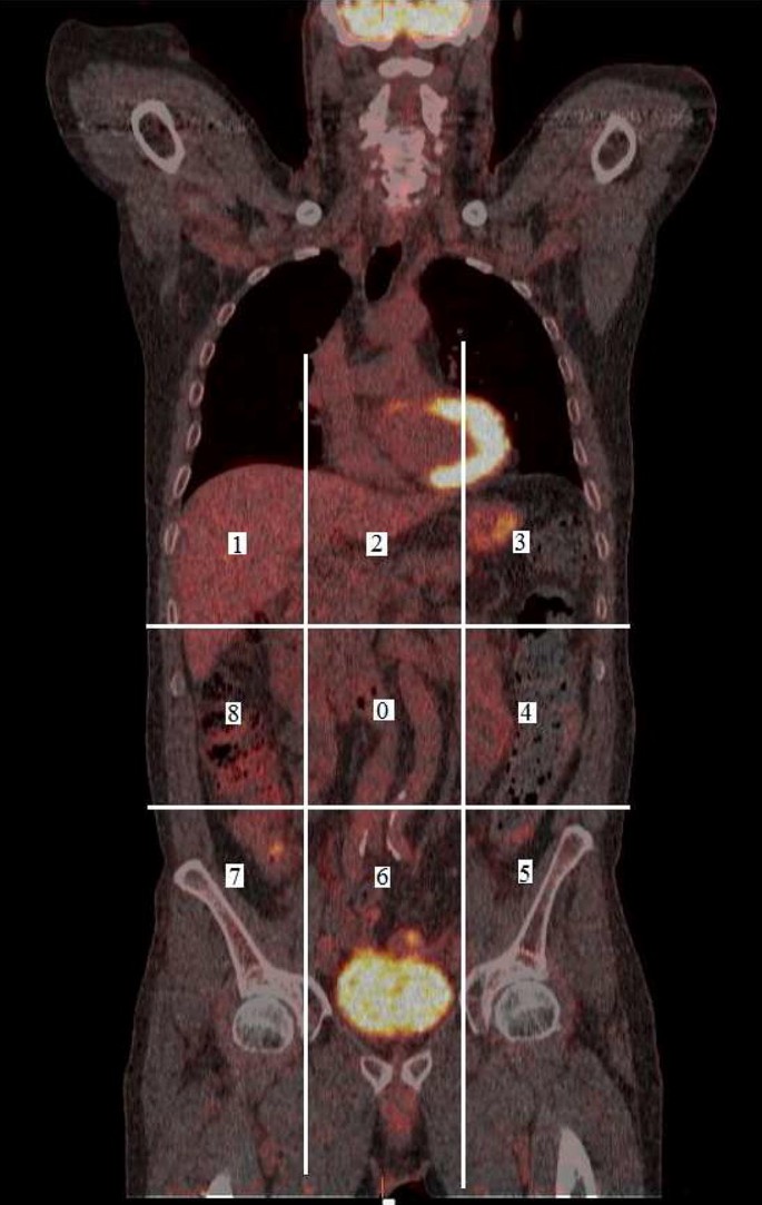 peritoneal cancer pet scan