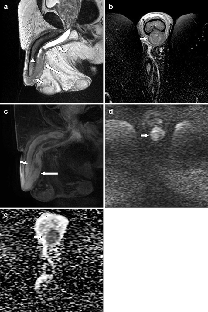 penis lung de 30 cm)