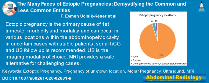 schematic representation of ectopic pregnancy