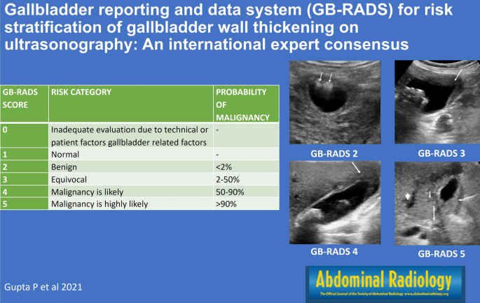 gallbladder sludge ultrasound report