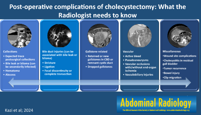Post-operative complications of cholecystectomy: what the