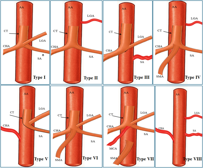 Anatomic variants of the celiac trunk and hepatic artery: insights from ...