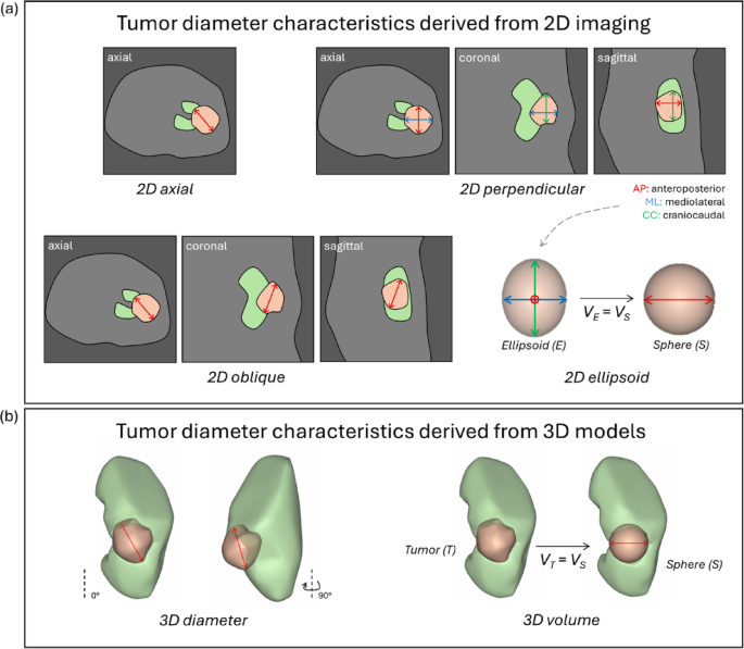 Measurement of renal tumor size: the impact of 2D versus 3D methods on ...