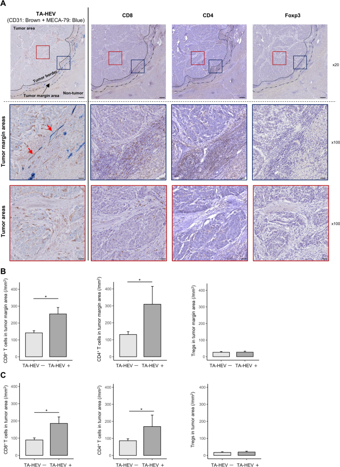 Tumor-associated high endothelial venules are associated with enhanced ...