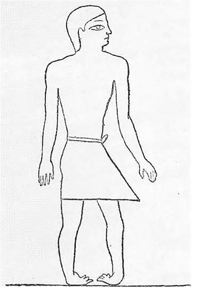 History Of Clubfoot Treatment Part I From Manipulation In Antiquity To Splint And Plaster In Renaissance Before Tenotomy Springerlink