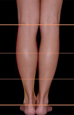 The Benslimane's Artistic Model for Leg Beauty | SpringerLink