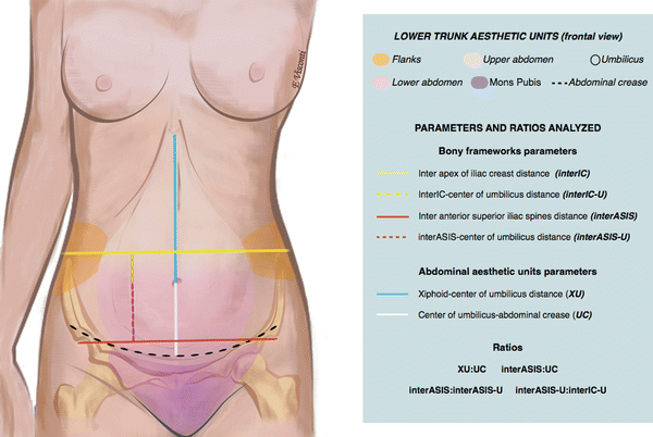 Concepts In Navel Aesthetic A Comprehensive Surface Anatomy Analysis Springerlink