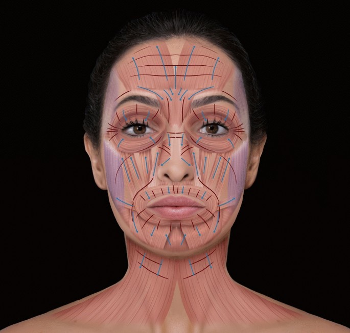 Avoiding Complications on the Upper Face Treatment With Botulinum Toxin: A  Practical Guide | SpringerLink