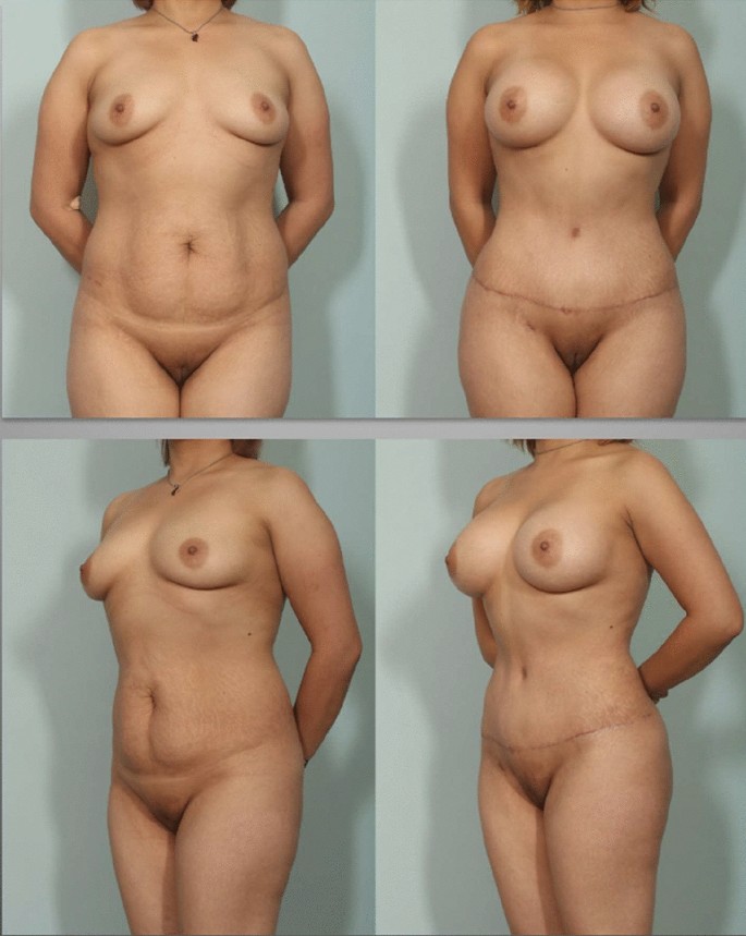 alt.binaries alyssa nude 