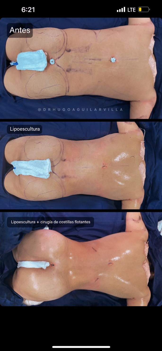 sul hyeon fake nude Abstracts | Aesthetic Plastic Surgery