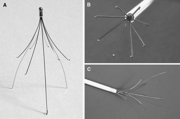 Early and Late Retrieval of the ALN Removable Vena Cava Filter: Results  from a Multicenter Study | SpringerLink