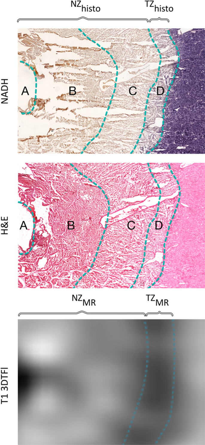 Detection of Ablation Boundaries Using Different MR Sequences in a Swine  Liver Model | SpringerLink