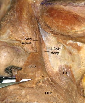 New anatomical insight of the levator labii superioris alaeque nasi and the transverse part of the nasalis | SpringerLink New anatomical insight of the levator labii superioris alaeque nasi and the transverse part of the nasalis | SpringerLink