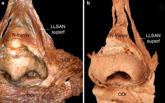 New anatomical insight of the levator labii superioris alaeque nasi and the transverse part of the nasalis | SpringerLink New anatomical insight of the levator labii superioris alaeque nasi and the transverse part of the nasalis | SpringerLink