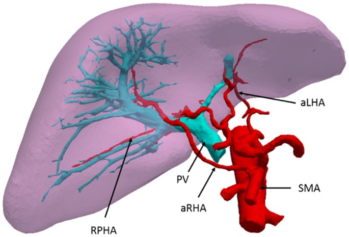 An accessory right hepatic artery derived from the superior mesenteric  artery for anterior right liver lobe supply: a case report | SpringerLink An accessory right hepatic artery derived from the superior mesenteric  artery for anterior right liver lobe supply: a case report | SpringerLink
