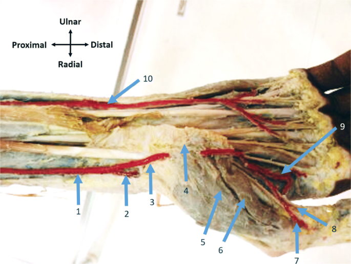 Superficial Palmar Branch Of The Radial Artery In A Fibromuscular Tunnel A Case Report Springerlink