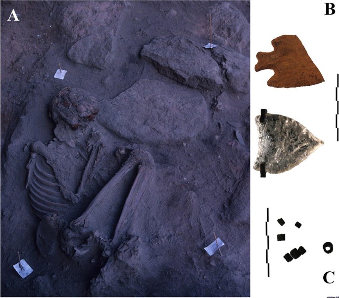 Rare Anatomic Variation On A 10 000 Year Old South American Skeleton The Case Of Iuzu Toca Dos Coqueiros Piaui State Brazil Springerlink Rare Anatomic Variation On A 10 000 Year Old South American Skeleton The Case Of Iuzu Toca Dos Coqueiros Piaui State Brazil Springerlink