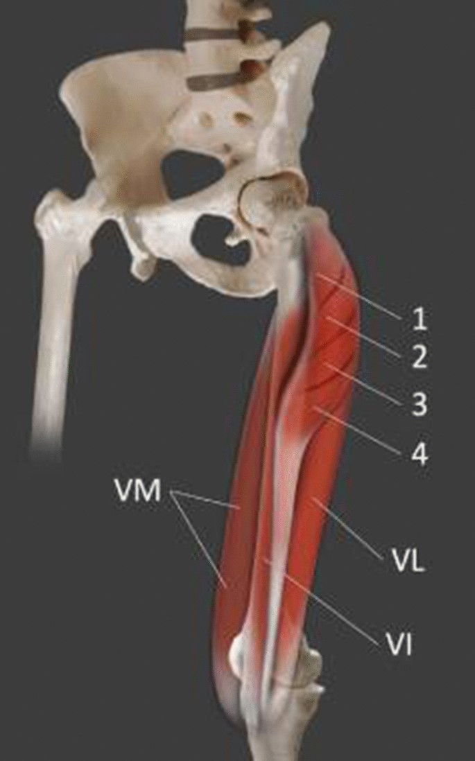 The Fifth Head Of Quadriceps Femoris For Sure Springerlink