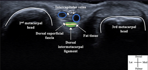 PDF) Topographic Description of Metacarpal Tendons and Ligaments of Anatoly  Donkey by Ultrasonography and Introducing a New Ligament