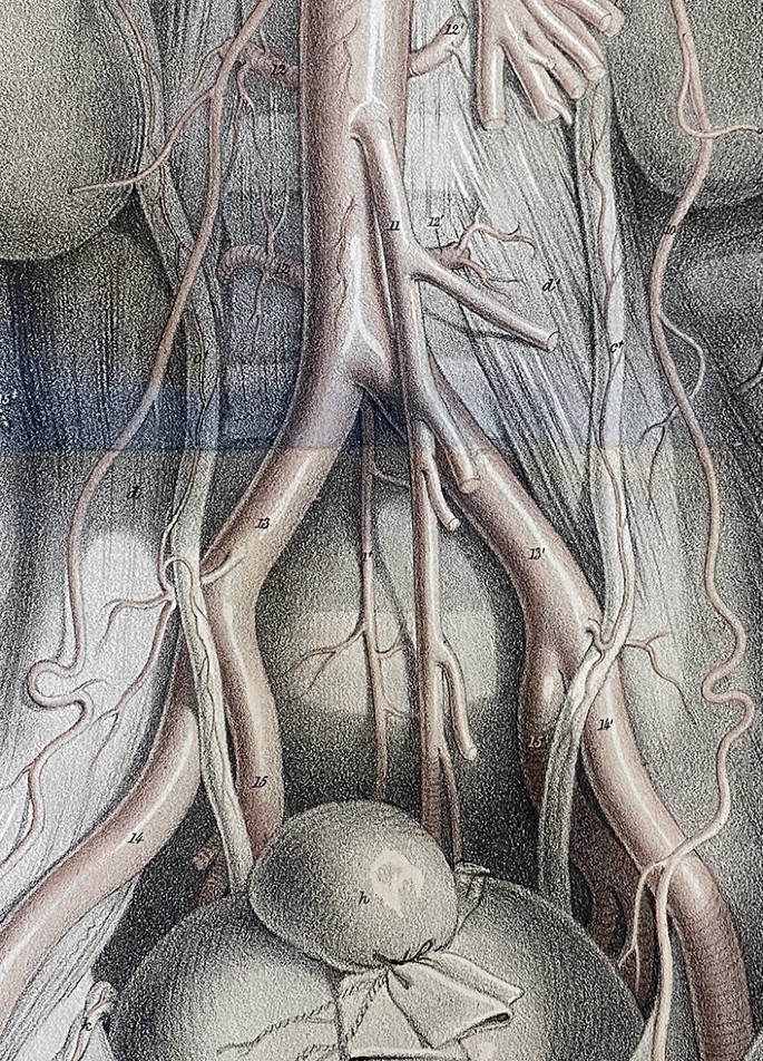 Normal, accessory, and aberrant branches of the common iliac artery