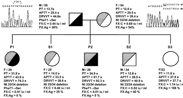 Two Novel Factor X Gene Mutations In A Chinese Family With Factor X Deficiency Springerlink