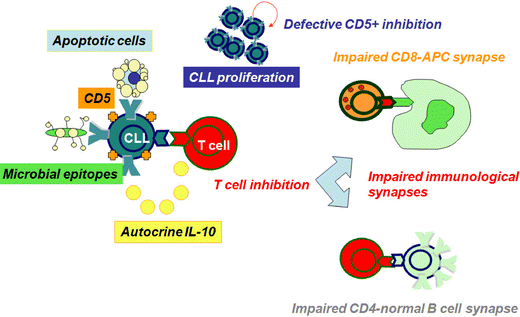 Immunological aspects in chronic lymphocytic leukemia (CLL) development |  SpringerLink