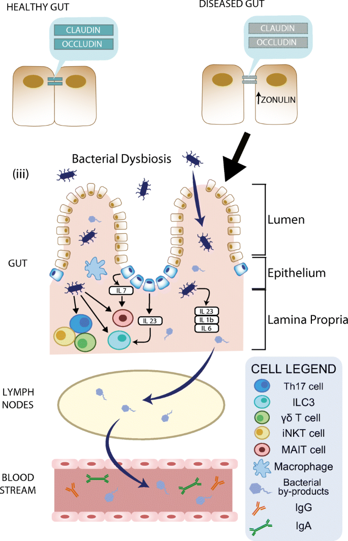 Systemic IgG repertoire as a biomarker for translocating gut