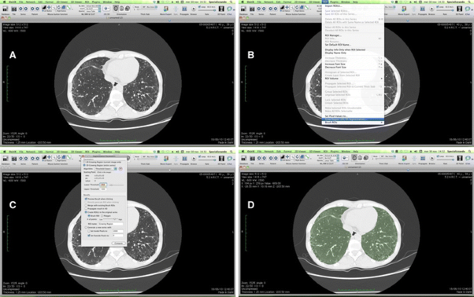 osirix free viewer osirix free viewer