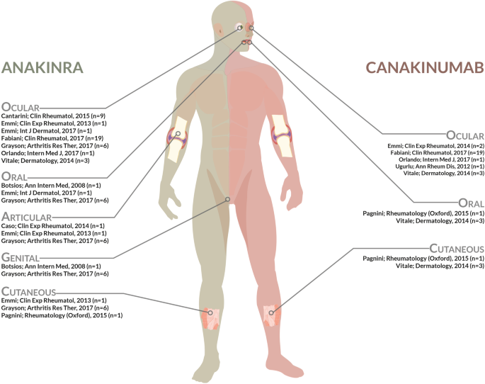 The Right Place Of Interleukin 1 Inhibitors In The Treatment Of Behcet S Syndrome A Systematic Review Springerlink The Right Place Of Interleukin 1 Inhibitors In The Treatment Of Behcet S Syndrome A Systematic Review Springerlink