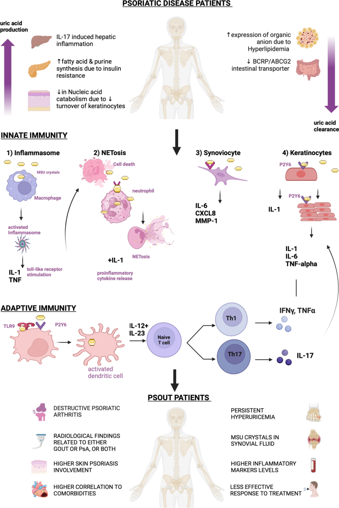 Understanding the interplay between psoriatic arthritis and gout: “Psout” | Rheumatology International