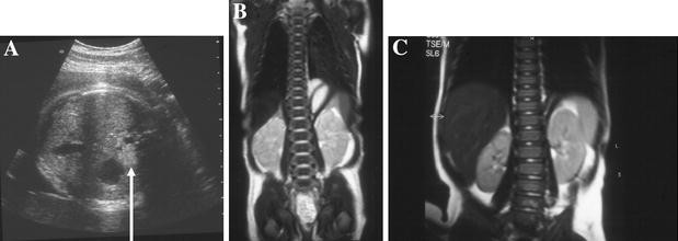 figure 25