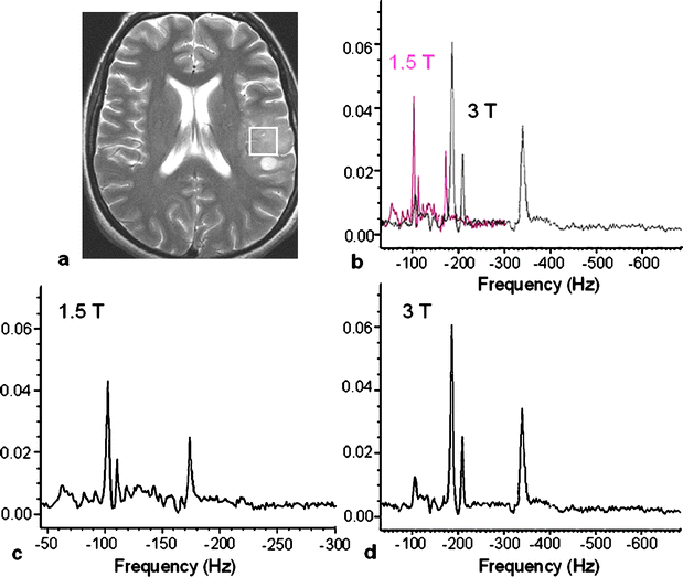 Proton MR spectroscopy of the brain at 3 T: an update | SpringerLink