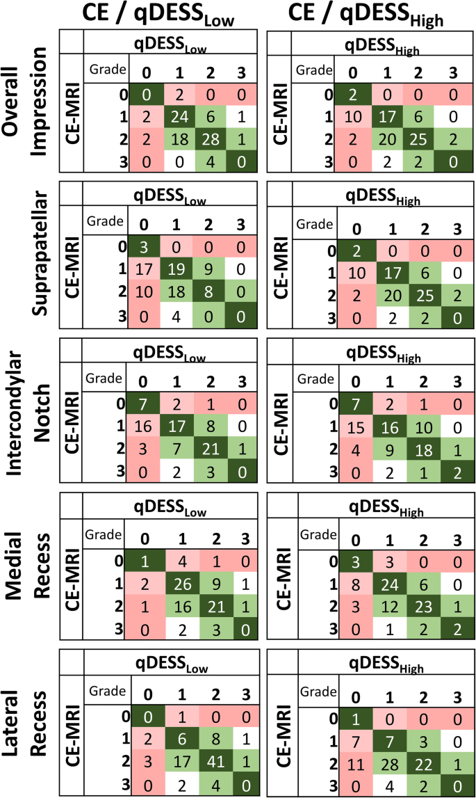 Non-contrast MRI of synovitis in the knee using quantitative DESS |  European Radiology