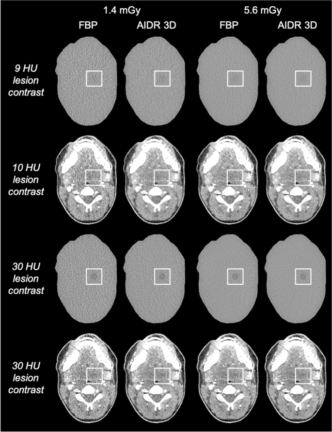 PDF) A comparison of reverse projection and laser scanning