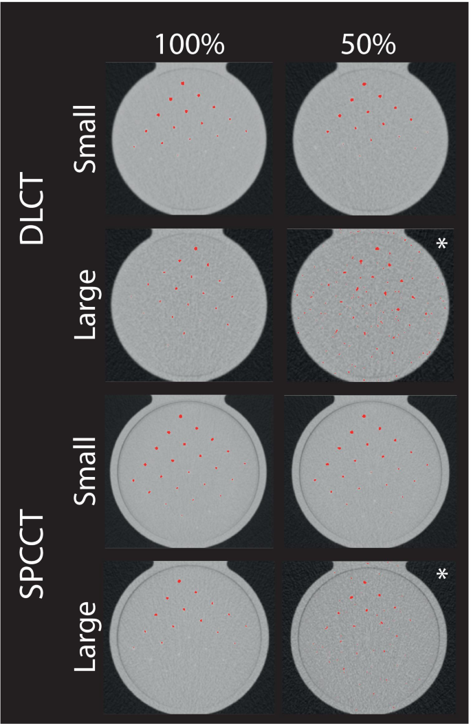 Improved Coronary Calcium Detection And Quantification With Low Dose Full Field Of View Photon Counting Ct A Phantom Study Springerlink