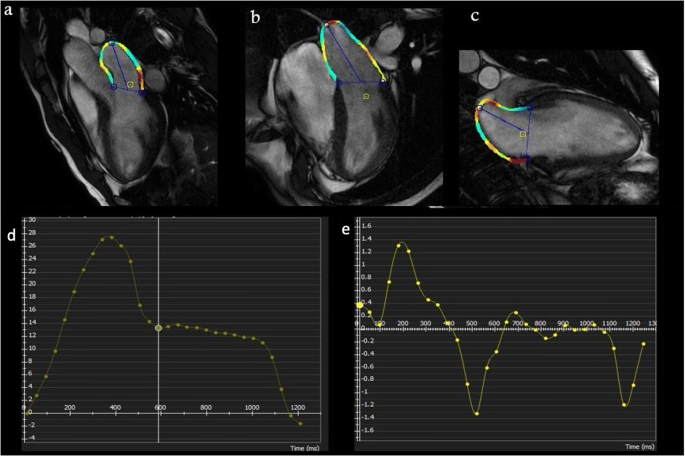 Strain imaging using cardiac magnetic resonance