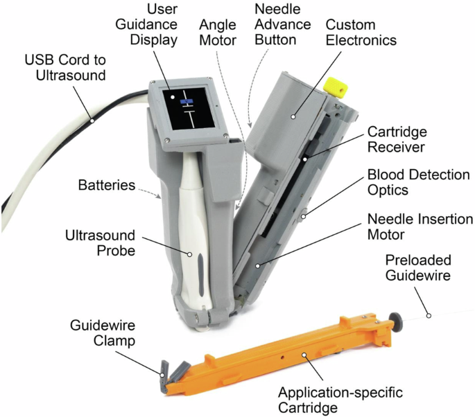 Đặt catheter thường cần người có kinh nghiệm ultrasound: Thiết bị mới để AI chỉ đường cho cây kim