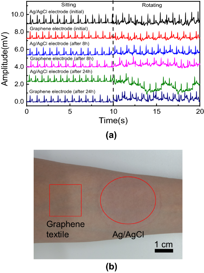 Screen Printed Graphene Electrodes On Textile For Wearable Electrocardiogram Monitoring Springerlink