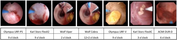 Consultation on kidney stones, Copenhagen 2019: aspects of intracorporeal  lithotripsy in flexible ureterorenoscopy | SpringerLink