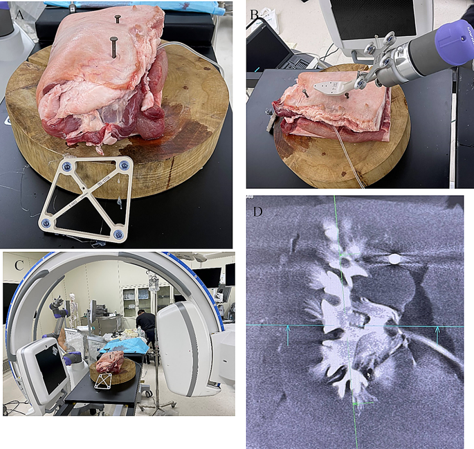 Feasibility of robot-assisted system for navigated needle positioning ...