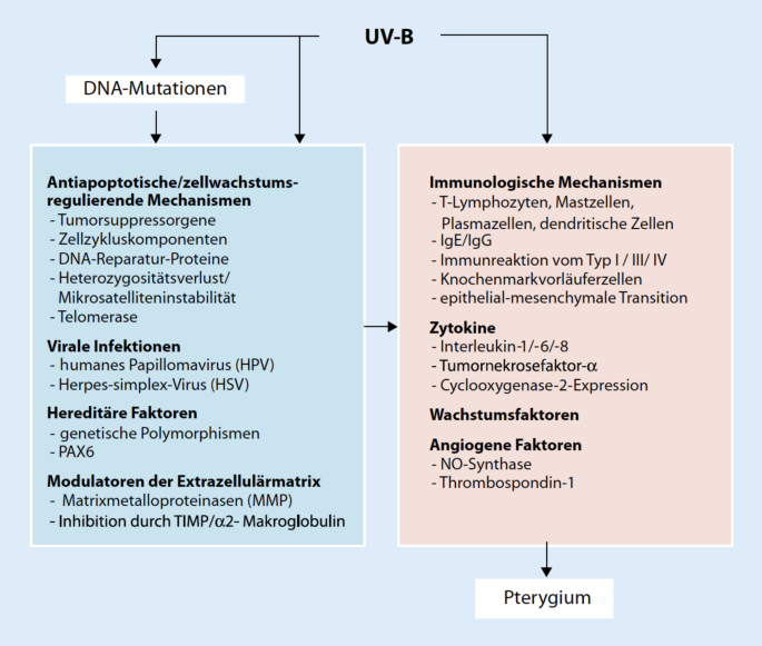 Pterygium: Pathogenese, Diagnose und Therapie | SpringerLink