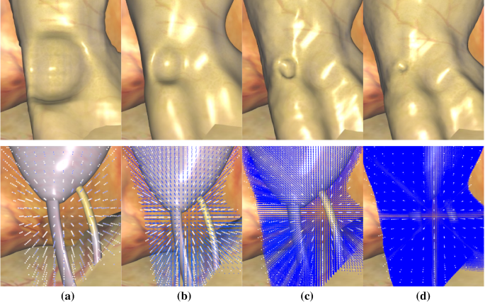 figure 15