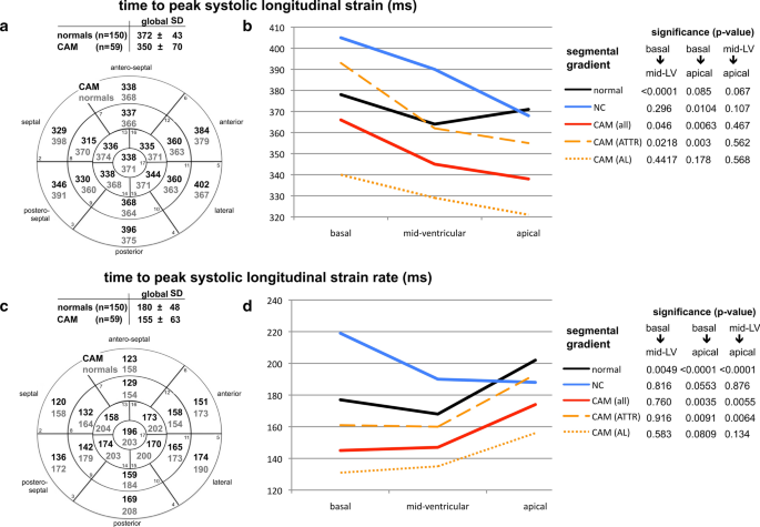 Three-dimensional Speckle Tracking Echocardiography in Light Chain Cardiac  Amyloidosis: Examination of Left and Right Ventricular Myocardial Mechanics  Parameters