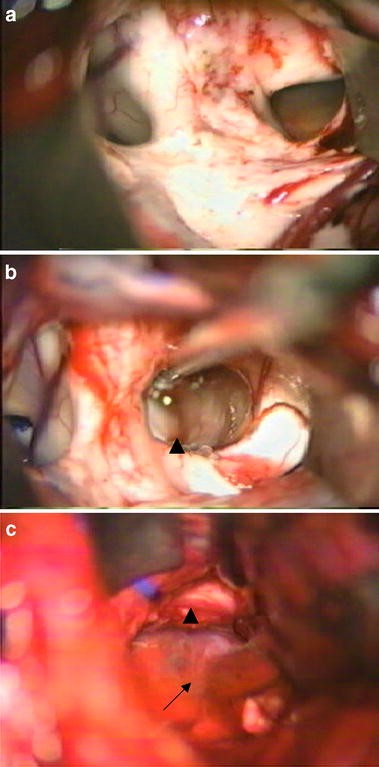 figure 23