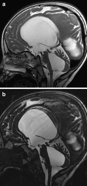 figure 26