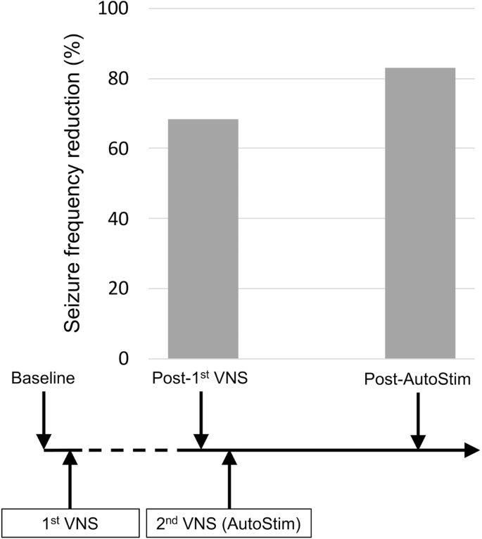 The vagus afferent network: emerging role in translational connectomics in:  Neurosurgical Focus Volume 45 Issue 3 (2018) Journals