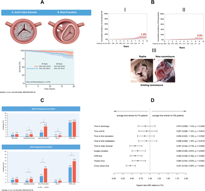 Cardiac Surgery 18 Reviewed Springerlink