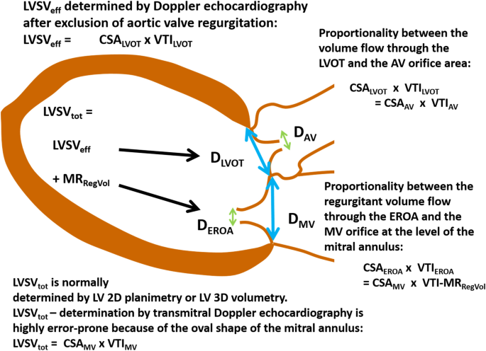 Echocardiographic assessment of mitral regurgitation: discussion of  practical and methodologic aspects of severity quantification to improve  diagnostic conclusiveness | SpringerLink